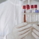 Alzheimer Araştırmasında Kan Biomarkeri İle Beyin Amyloidi İlişkisi Benzer
