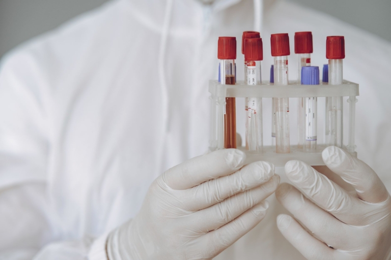 Alzheimer Araştırmasında Kan Biomarkeri İle Beyin Amyloidi İlişkisi Benzer